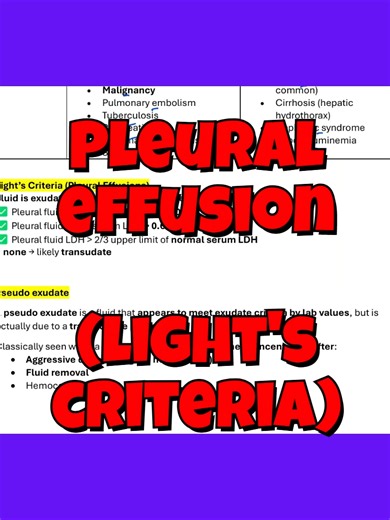 Pleural Effusion - Light's Criteria#medicalstudent #medicaleducation #medschool #usmle #usmlestep1 #nursingstudent #nursing #pathology #acuteinflammation #exudate #pleuraleffusion #ECF #ICF #light'scriteria #heartfailure #CHF #pneumonia #LDH #ABIM #pulmonary #PCCM #CCM #criticalcare #criticalcaremedicine