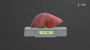 Video: Gross Anatomy of the Liver