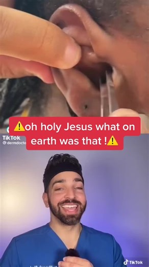 #blackhe #warner #pimplesandblackheads #cystexplosion #cyste #warning #dre #warn #warn #fyp what was that at the end ?