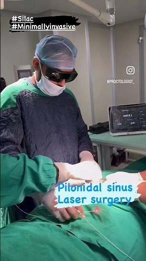 Pilonidal sinus laser surgery / minimally invasive surgery for Pilonidal sinus | Silac