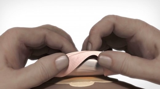 Complications liées à votre stomie