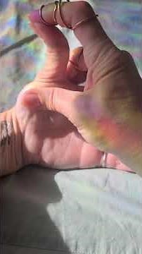 What are Ring Splints?