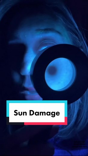 Reverse Sun Damage: Tips from a Dermatologist