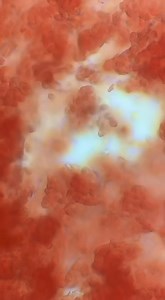 18 reactions · 11 shares | Something’s wriggling in this dog’s blood...