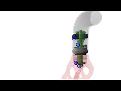 The Enhanced Quickie Q7 and Zippie Zone Caster Adjustment System