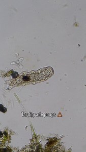 This little tardigrade poops and an amoeba crawls into it. 😂 I recorded this footage almost eight years ago, and it was the first time I ever saw a water bear poop. I was so excited to see it. 😂 . Tardigrades are microscopic animals with a very simple brain and around a thousand cells in their entire body. As I quickly learned, they are also notoriously active poopers. They poop all the time. In some species with separate sexes, males locate females that are ready to be fertilized through chem