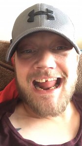 Save Thousands On Your New Smile 😀👄💓 Introducing INSTAsmile Clip-On Veneers ... | instasmile