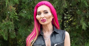 Model With 'World's Biggest Cheeks' Shows The Way She Looked Before Transformation