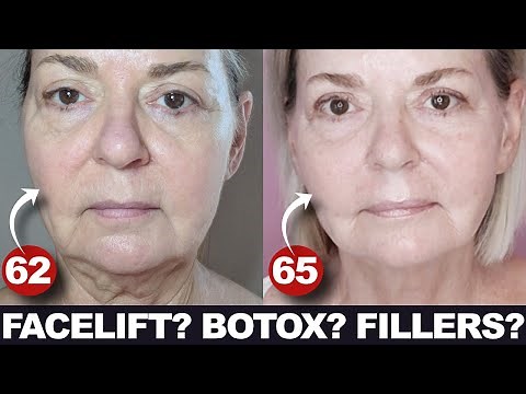 FACELIFT? BOTOX? FILLERS? - The Real Truth Over 50