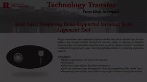 Scan Ease: Temporary Bone-Supported Intraoral Scan Alignment Tool