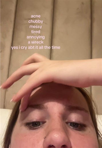 Crying Over Acne: Managing Emotional Struggles