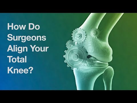 What Surgeons Never Tell You About Knee Alignment