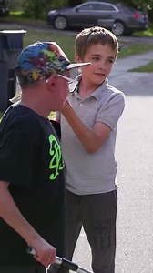 2.8M views · 2.7K shares | Meet Elio, the boy whose skin grows too fast | Born Different | Facebook