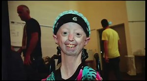 We featured Hayley Okines a number of times on this programme - a young woman who faced the difficulties life threw at her with a great deal of humour and fun, despite having the rare genetic disorder progeria. Sadly she died earlier this month and her funeral was held today. Her condition caused her to age prematurely. Hayley reached the age of 17, several years longer than many people with progeria ever do. Today a letter from the Prince of Wales paying tribute to Hayley's "infectious love of 