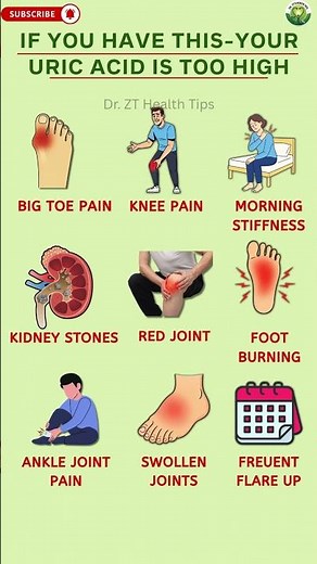 signs and symptoms that Your Uric Acid is High | Dr. ZT’s Health Tips #healthtips