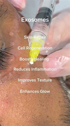 Exosomes: cellular regeneration from within. 🧬