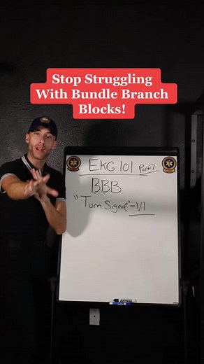 Understanding Bundle Branch Blocks in EKG | ECG Basics