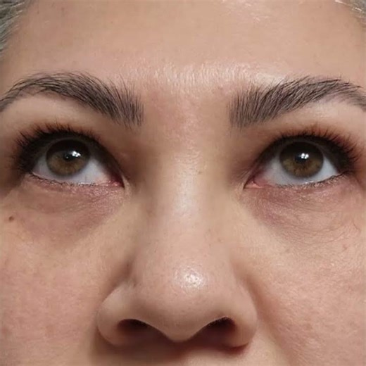 Latisse Medication for Growing Lashes Naturally · Rancho Cucamonga, Inland Empire