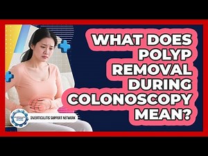 What Does Polyp Removal During Colonoscopy Mean?