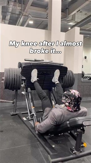 My knee 😂😂#viral #fyp #goviral #trending #explorepage