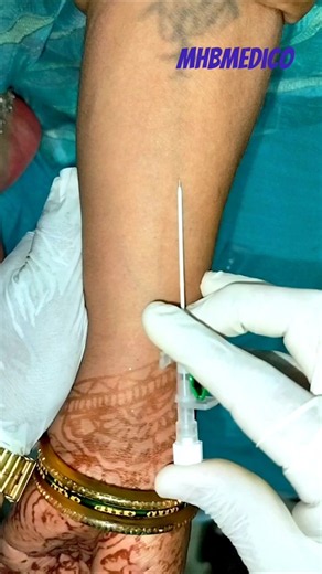 CANULA INSERTION TECHNIQUE | GREEN CANNULA 💚💉 | EASY STEP BY STEP #ivcannulation