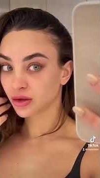 Forehead Reduction Scar Update | Healing Process and Results!🙏🤗