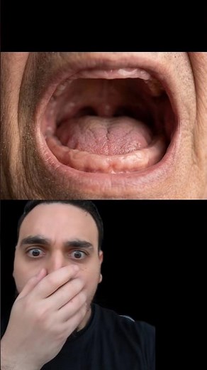 Born With NO Teeth: Anodontia | Dentist Reacts #oralhealth