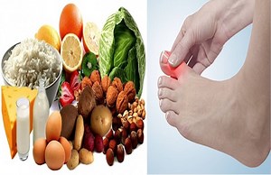 ये 5 फूड्स बढ़ाते हैं खून में Uric Acid का स्तर, छोड़ने में ही है भलाई