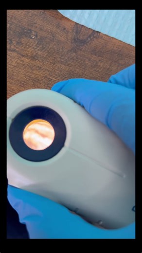 Dermatoscope: 👉 Ver descripción/ see description