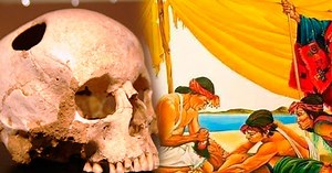 ¿Sabías que los incas realizaron con éxito complejas cirugías en el cráneo?