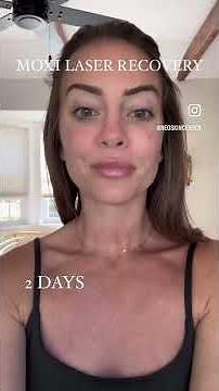 MOXI LASER RECOVERY PROCESS- skin care treatment, skin rejuvenation, facial laser