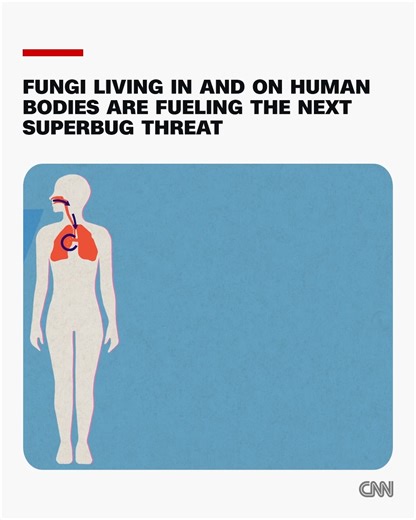 A new superbug threat is spreading around the world. The culprit: microscopic fungal spores that live in and on human bodies and in the dirt and air. Torrence Irvin believes the life-threatening fungi called Coccidioides entered his lungs in June 2018 while he was relaxing in his backyard in Patterson, California. “I was sitting in my lounger enjoying a nice summer day, playing games on my phone and having a cocktail,” said Irvin, who came close to death before a specialist correctly diagnosed h