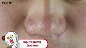 108K views · 387 reactions | Bye-Bye Comedones & Blackheads Deep Cleanses Pores Repairs & Firms Soothes & Calms Mositurizes ✨3-in-1 Cleanser [Remover+Cleanser+Spa] Was $21.50 Now $15.95 https://goo.gl/AdTT9N Soft Silicone Brush Head  360 Degree Deep Cleansing  subscribe now MKUP SG 美咖 ig➡ https://goo.gl/BLM3dy #MKUP #美咖 #MKUP美咖 #beyourself #CalendulaDeepPoreCleansingMousse #DeepPoreCleansing | MKUP 美咖 | Facebook