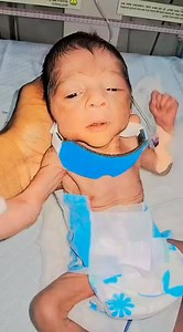 What a hilarious baby | Baby born in critical condition | Preterm baby birth | Premature born baby #baby #viral #trending | Anoop Gautam