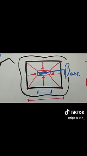 INCRUSTACIÓN DENTAL: Tipos, preparación y colocación