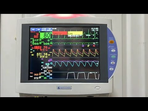 心電図モニター 実際の測定 Demo-Alarm (デモアラーム) [NIHONKOHDEN LifeScope TS]