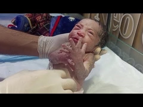LBW Newborn With High RBS | Immediate Oil Care & NICU Management After Receiving From Labor Room