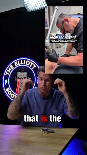 Tattoo Removal Fails You Won't Believe!