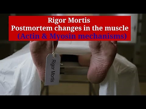 Rigor mortis | Postmortem changes in the muscle | mechanism of Actin & Myosin protein filament.