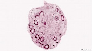 Algae: A green climate solution? – DW – 09/10/2021