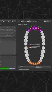 exocad Training Session - Seth Potter