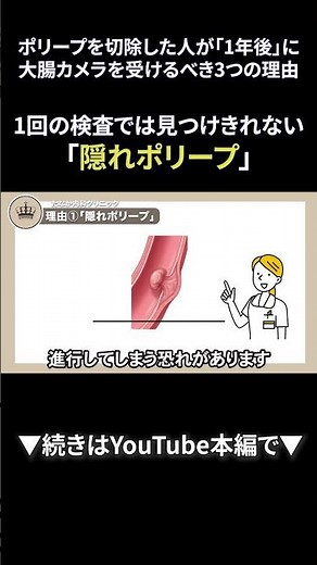 45 ポリープを切除した人が「1年後」に大腸カメラを受けるべき3つの理由①｜【胃腸と内視鏡の専門チャンネル】たなか内科クリニック#shorts