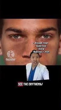 Dermatologist Explains Seborrheic Dermatitis