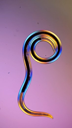My Microscopic World | The most abundant animals on the planet are roundworms, or nematodes. For every human there is an estimated 60 BILLION nematodes in the top... | Instagram