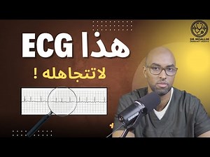 "لا تتجاهل هذا الـ ECG! قد يكون بداية الكارثة 💥"