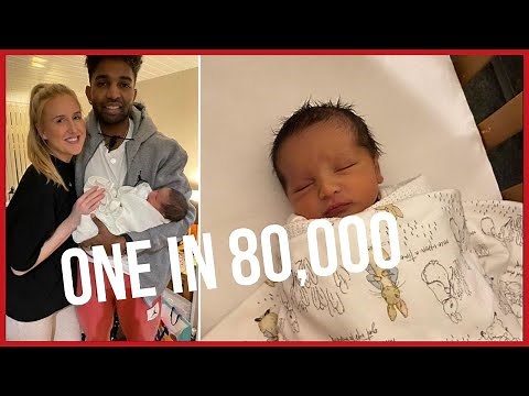 New mum speechless after son's rare 'mermaid birth'