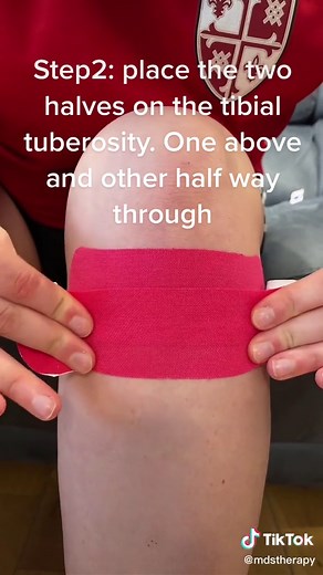 How to Tape a Meniscus Tear in the Knee: Step-by-Step Guide
