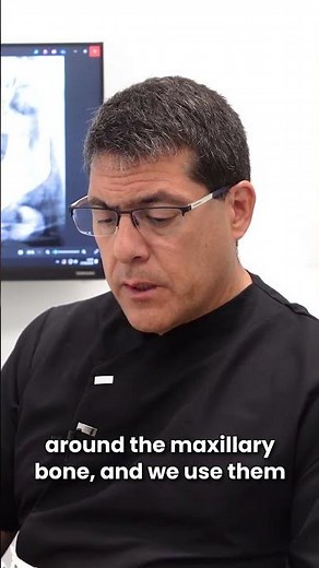 Subperiosteal Dental Implants: A Comprehensive Guide | Dr. Óscar Ríos