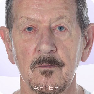 My Perfect Facial At home full facial contouring treatment which...