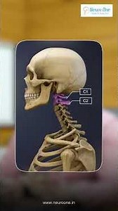 Understanding Spastic Gait: Why You Shouldn't Ignore Neck Injuries | Dr. S. Vijay Kumar